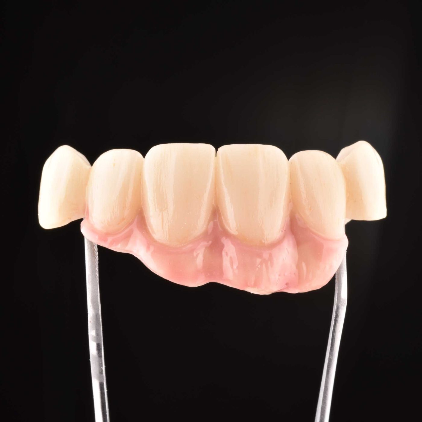 zyrconia bridge dental implant